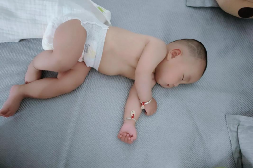 绵阳宝宝上火有眼屎